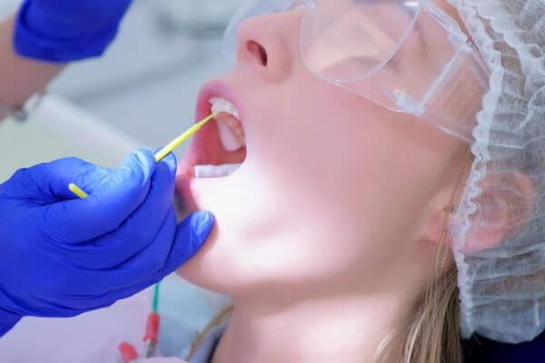 Dental Sealants in Wayne County, NY