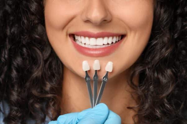 Dental Veneers in Wayne County, NY | Porcelain Veneers in Clyde